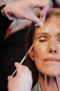 botox facial injections in chalmette lolas med spa